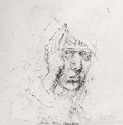 Albrecht Durer Sele-Portrait with Bandage oil on canvas